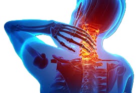 Neck Pain