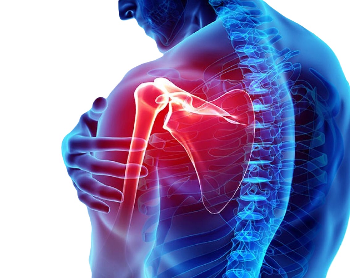 Shoulder Pain