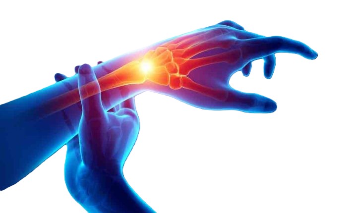 Wrist Pain